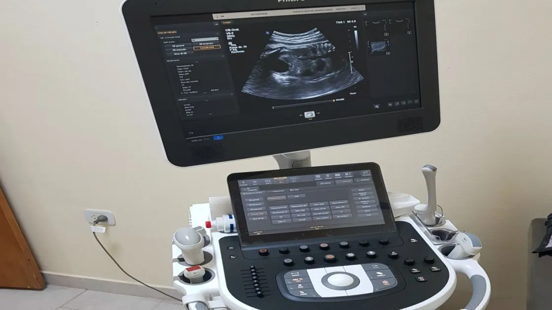 el-aparato-el-ecografo-permite-ver-un-cuerpo-cinco-dimensiones